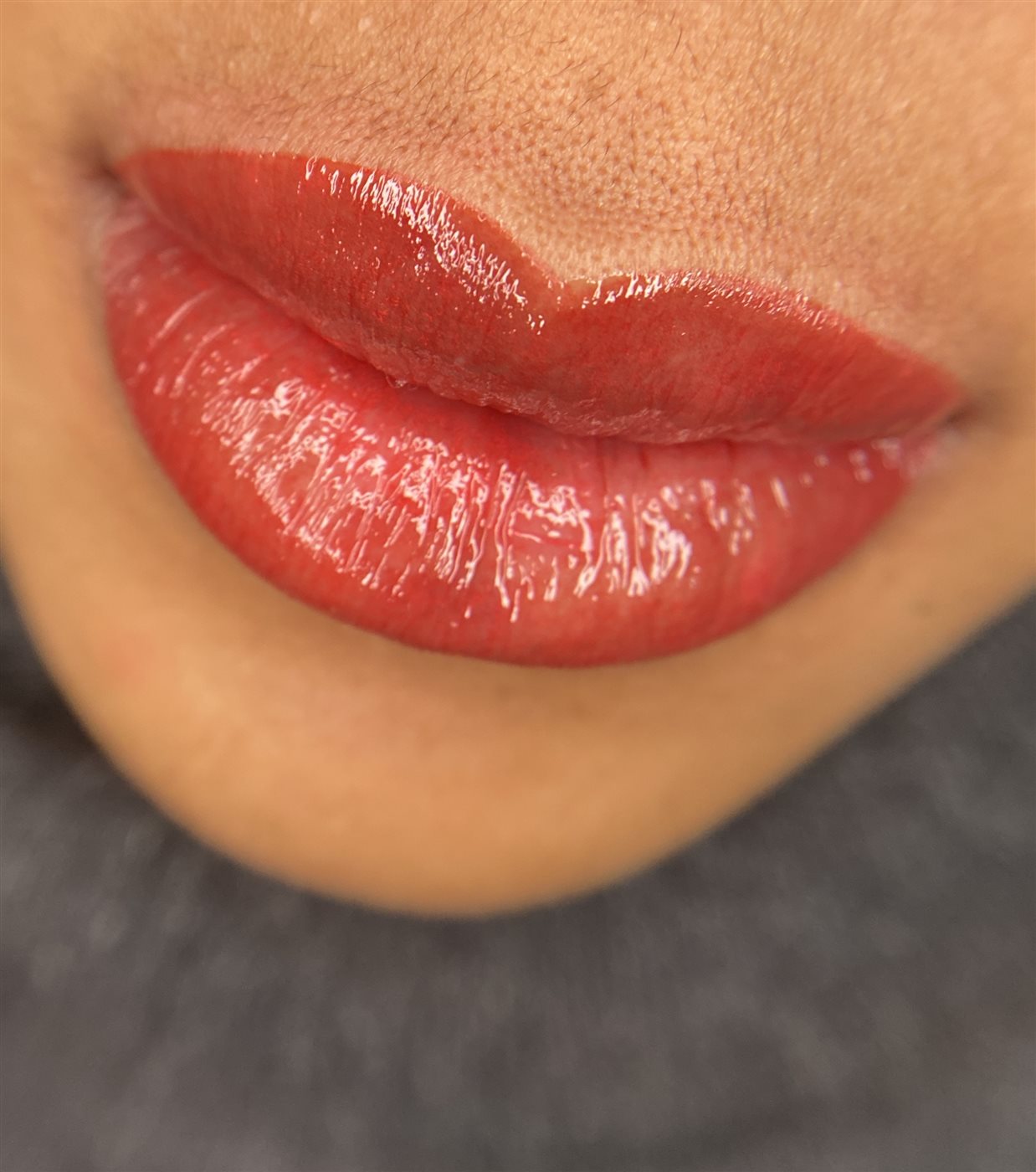 Pigmentation des lèvres — Blush Lips & Dark Lips